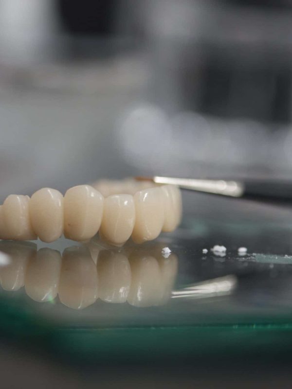 Bridge-Zirconia-Implant-Lab Bridge-Zirconia-Implant-Lab