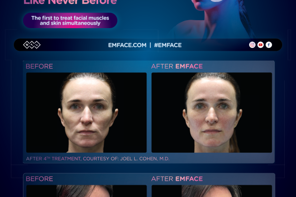 Emface_LF_Stand-insert_FAA_ENUS100_preview Emface_LF_Stand-insert_FAA_ENUS100_preview