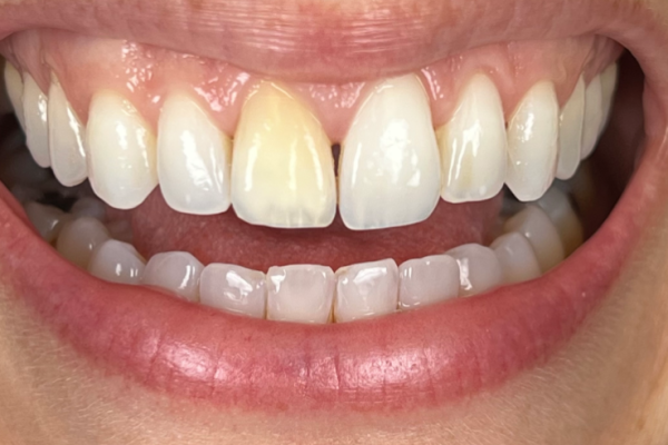 GP Smile Before