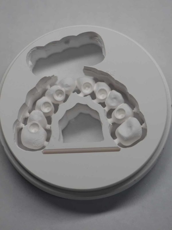 Milled-Zirconia-Bridge-for-Implants Milled-Zirconia-Bridge-for-Implants